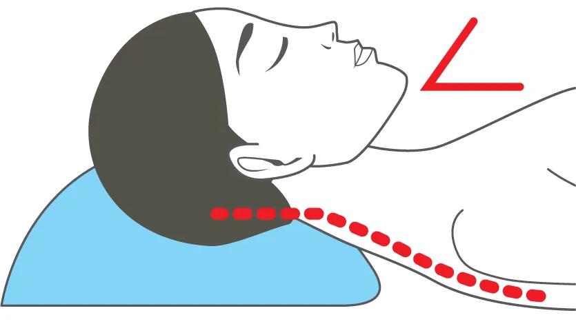 Chin tucked down: less air and snoring